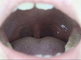 300人のおくち 第2集 サンプル動画サムネイル